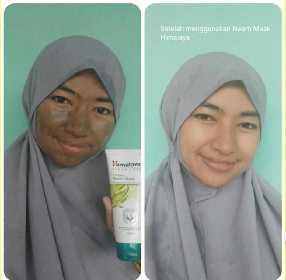 Testimoni menggunakan masker Himalaya